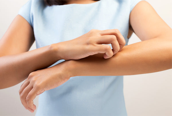 Top 10 Facts about Eczema